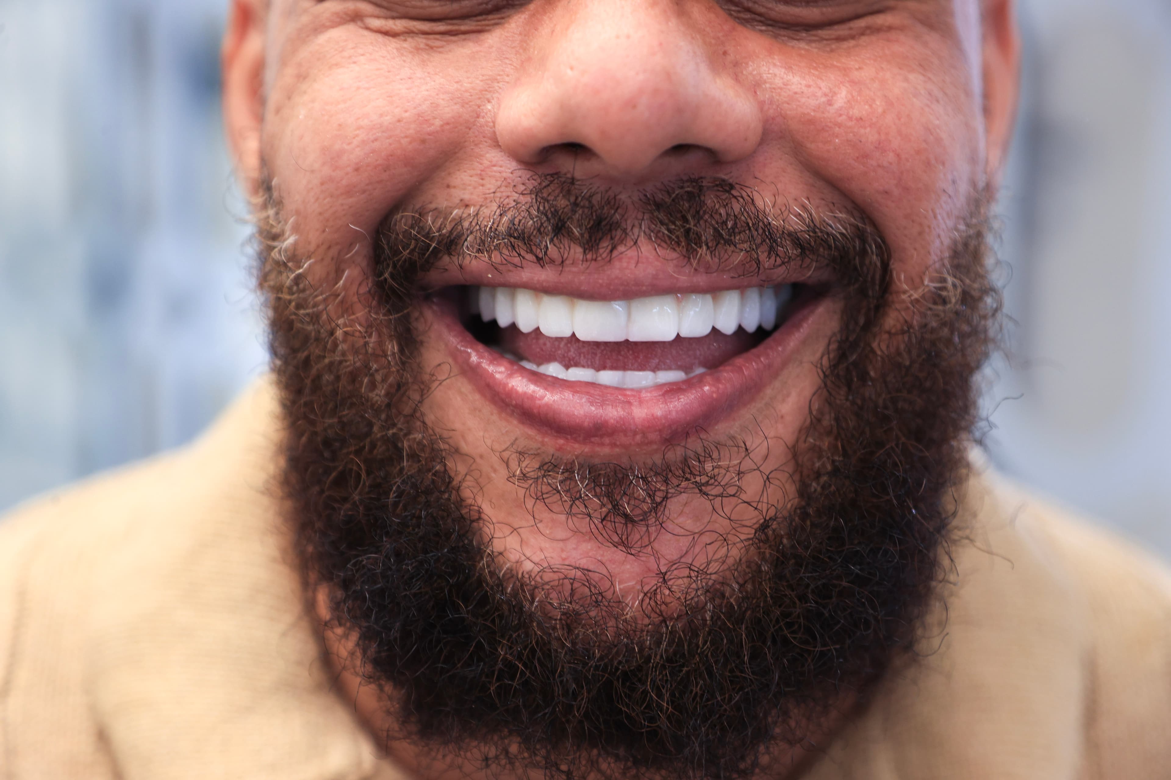 Lela Dental before and after treatment result after